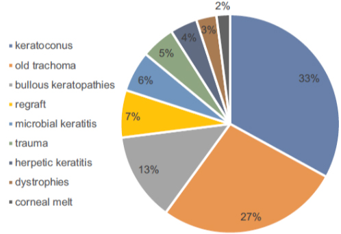 corneal-transplant-chart